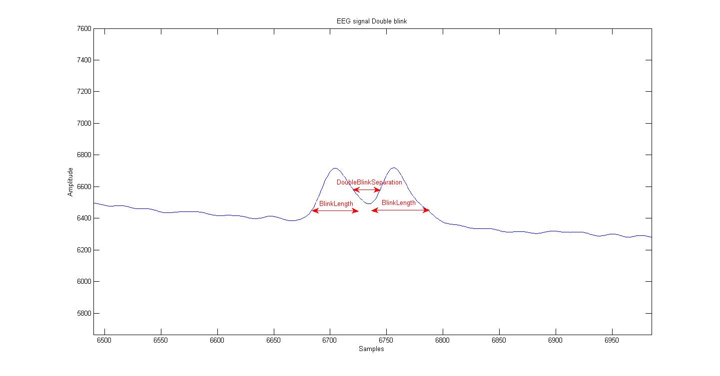 Screenshot: EEG signal double blink